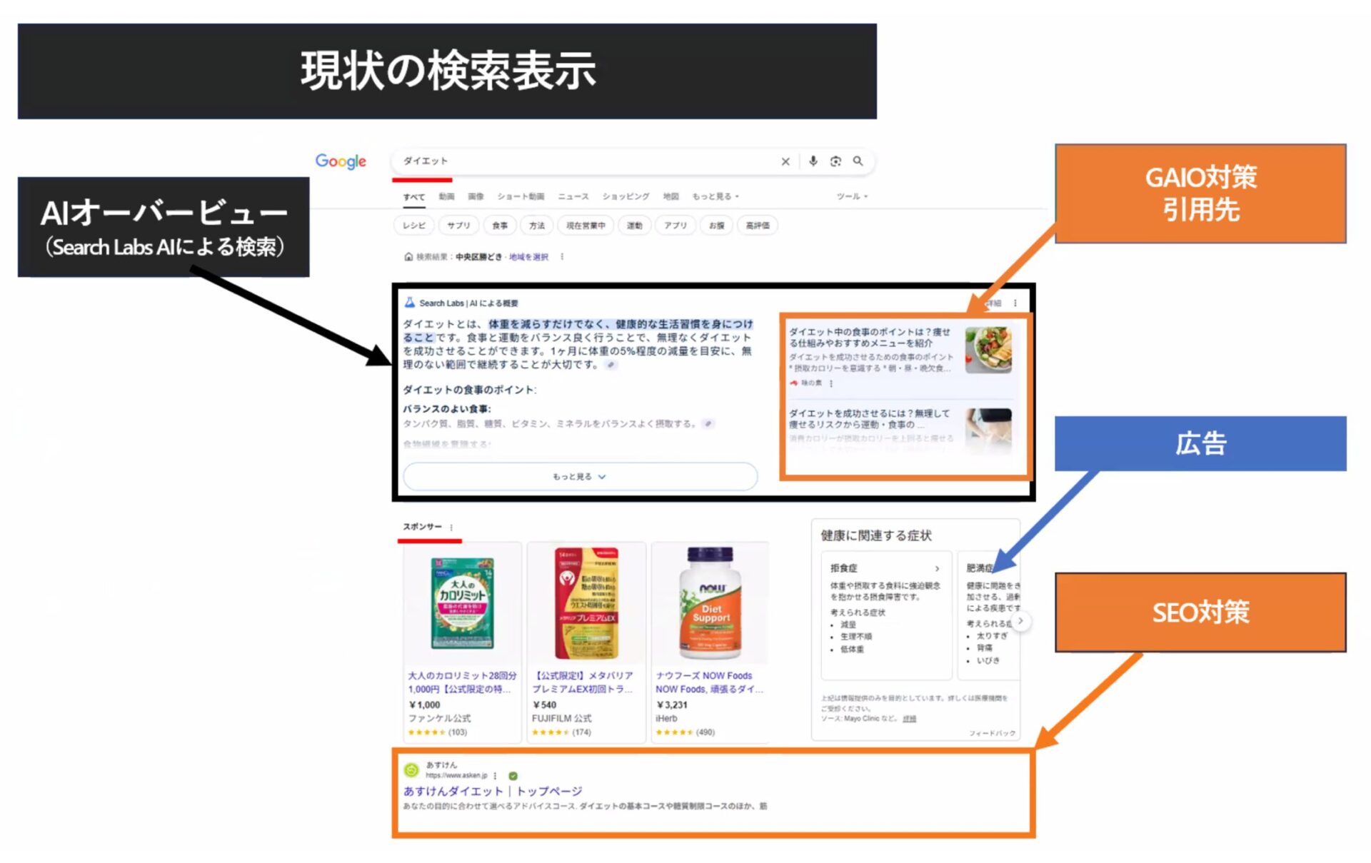 GAIO対策